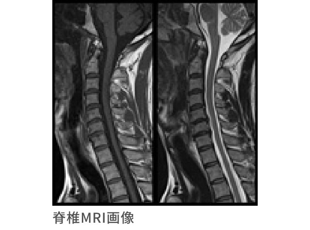 ヘアファンデーション ストア mri