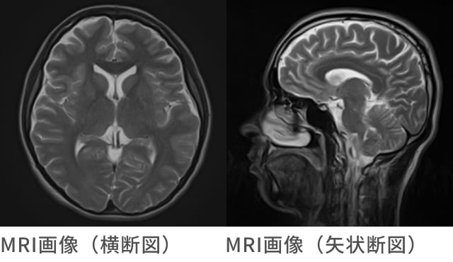 頭部MRI・MRA単体検査 | 人間ドックのアムス丸の内パレスビル